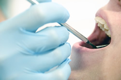感染根を作らないことが歯内療法では重要です