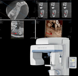 歯科用CT